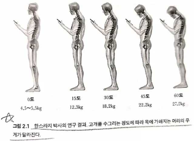 고개를 수그리는 정도에 따라 목에 가해지는 머리의 무게, 한스라지 박사의 연구 결과